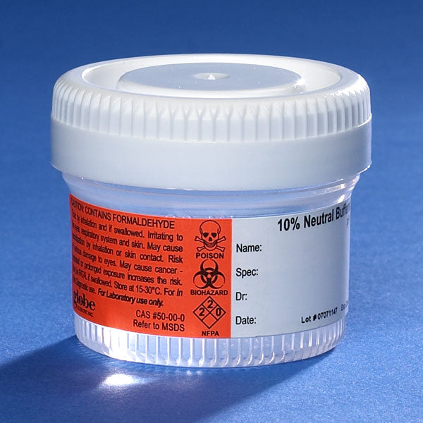 Pre-filled NBF container, 40mL, white SC, PP, MG, hazard label | GLO1-6520FL