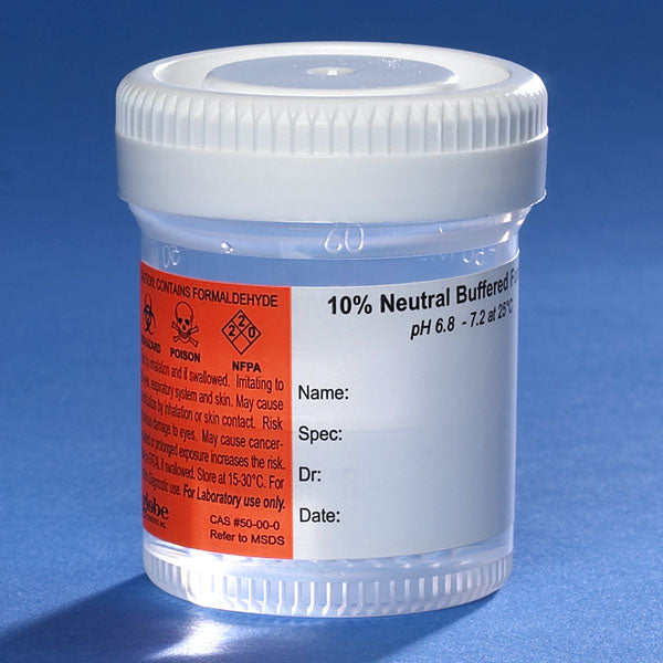 Pre-filled NBF container, 60mL, white SC, PP, MG, hazard label | GLO1-6522FL