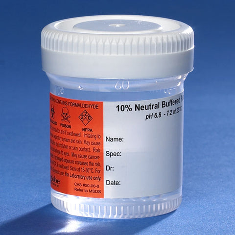 Pre-filled NBF container, 60mL, white SC, PP, MG, hazard label | GLO1-6522FL