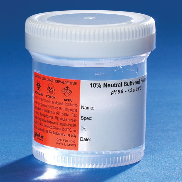 Pre-filled NBF container, 90mL, white SC, PP, MG, hazard label | GLO1-6525FL