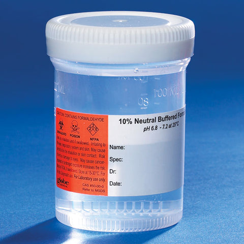 Pre-filled NBF container 120mL, white SC, PP, MG, hazard label | GLO1-6527FL