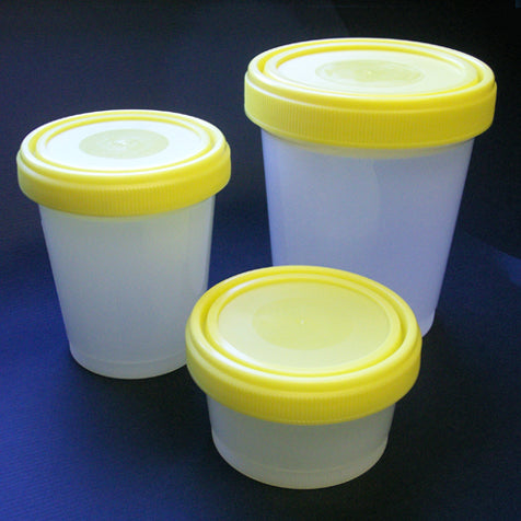 Histology container, 250mL, PP, yellow S-SC, MG | GLO1-6540